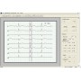 48 timers Holter EKG med optager og software
