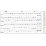 48 timers Holter EKG med optager og software