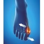 Epitact - Orteză corectivă flexibilă pentru zi - Mare