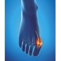 Epitact - Protecție Hallux Valgus - Medie (39-41)