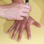 Terapia cu laser Physiolaser 2.0
