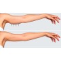 Ultrasuoni per la bellezza UltraSonicWaves Beauty dotazione CORPO