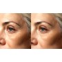 Ultrasuoni per la bellezza UltraSonicWaves Beauty dotazione CORPO, VISO e DECOLLETE